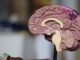 Learn about the 10 most common mental disorders and their typical age of onset. Recognize early signs of anxiety, depression, ADHD, and more.
